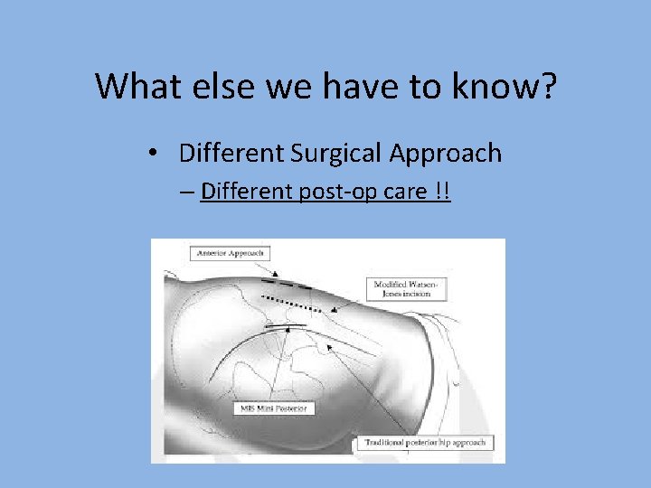 What else we have to know? • Different Surgical Approach – Different post-op care