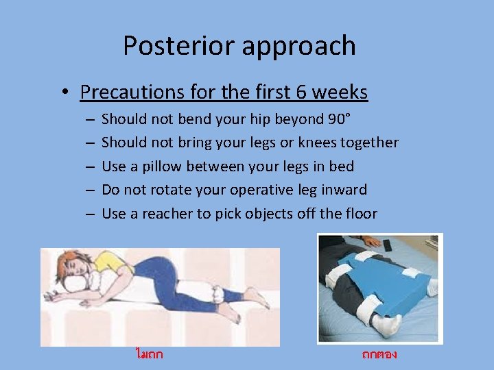 Posterior approach • Precautions for the first 6 weeks – – – Should not