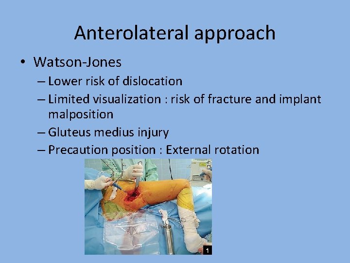 Anterolateral approach • Watson-Jones – Lower risk of dislocation – Limited visualization : risk