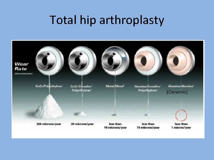 Total hip arthroplasty 