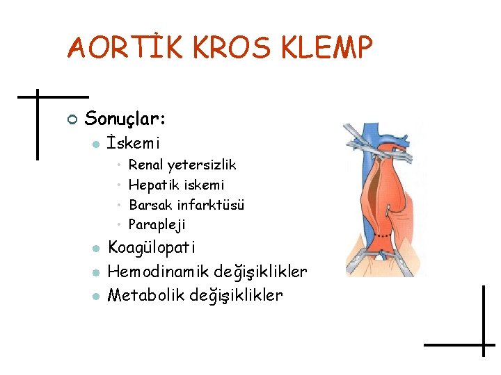 AORTİK KROS KLEMP ¢ Sonuçlar: l İskemi • • l l l Renal yetersizlik