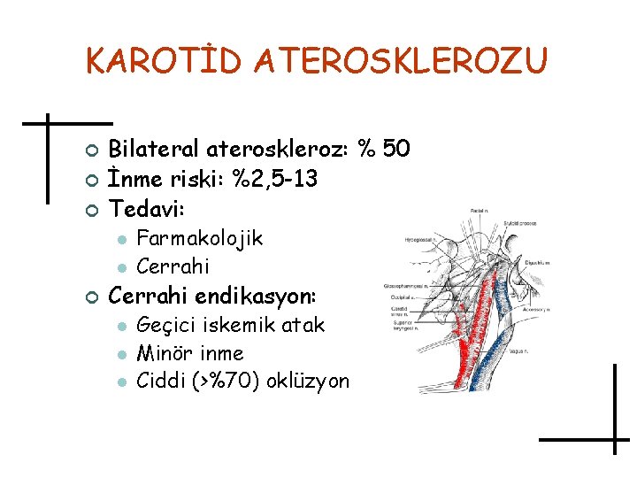 KAROTİD ATEROSKLEROZU ¢ ¢ ¢ Bilateral ateroskleroz: % 50 İnme riski: %2, 5 -13