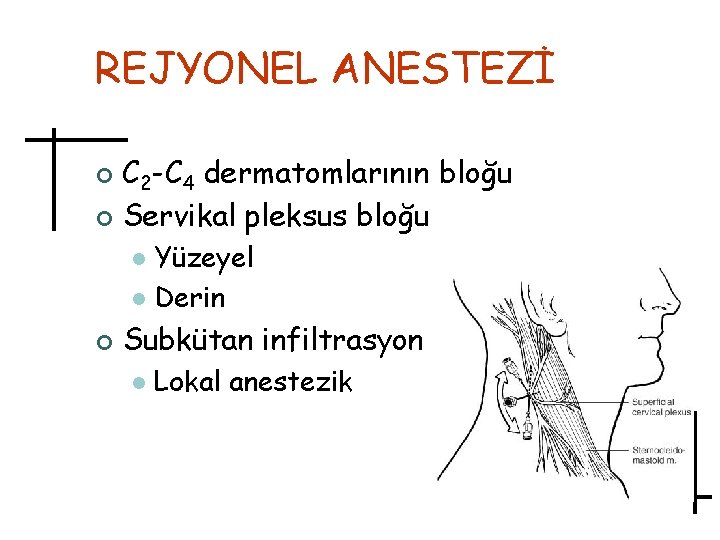 REJYONEL ANESTEZİ C 2 -C 4 dermatomlarının bloğu ¢ Servikal pleksus bloğu ¢ Yüzeyel