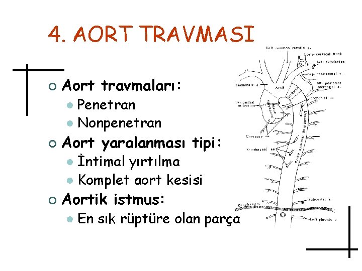 4. AORT TRAVMASI ¢ Aort travmaları: Penetran l Nonpenetran l ¢ Aort yaralanması tipi: