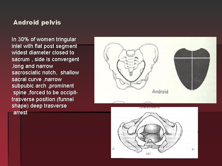 Android pelvis In 30% of women tringular inlet with flat post segment widest diameter