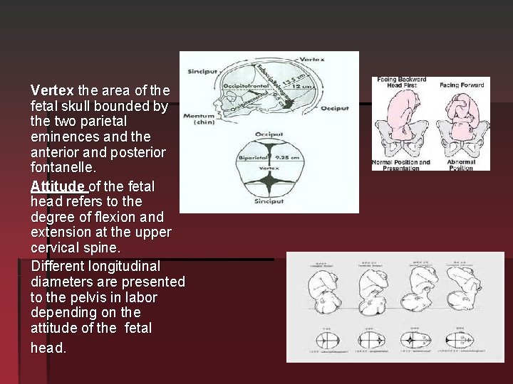 Vertex the area of the fetal skull bounded by the two parietal eminences and