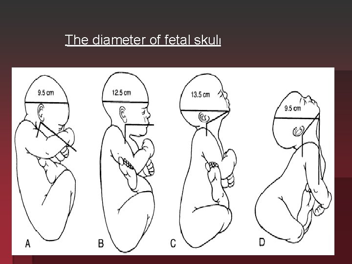 The diameter of fetal skull 