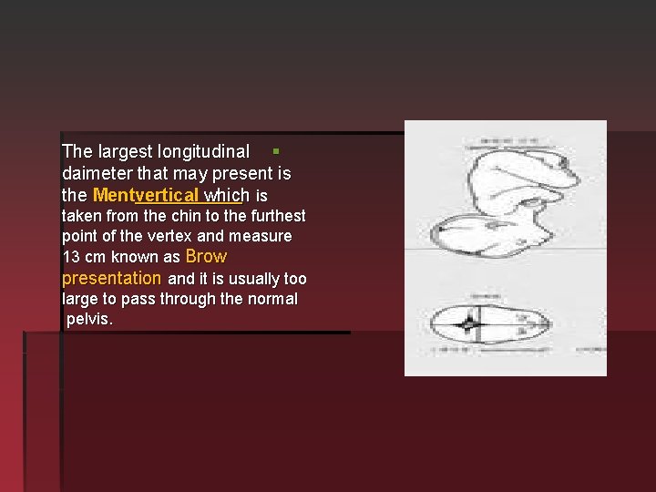 The largest longitudinal § daimeter that may present is the Mentvertical which is taken