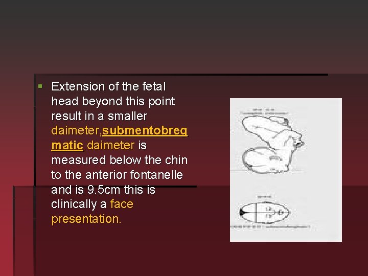 § Extension of the fetal head beyond this point result in a smaller daimeter,