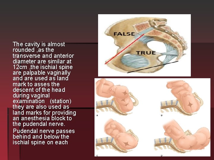 The cavity is almost rounded , as the transverse and anterior diameter are similar