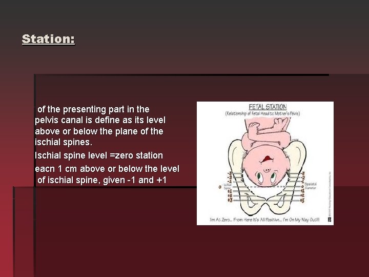 Station: of the presenting part in the pelvis canal is define as its level