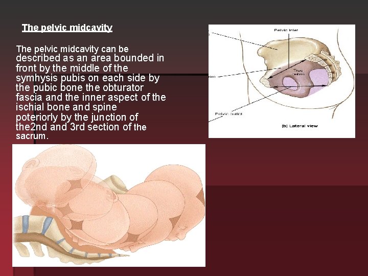 The pelvic midcavity can be described as an area bounded in front by the