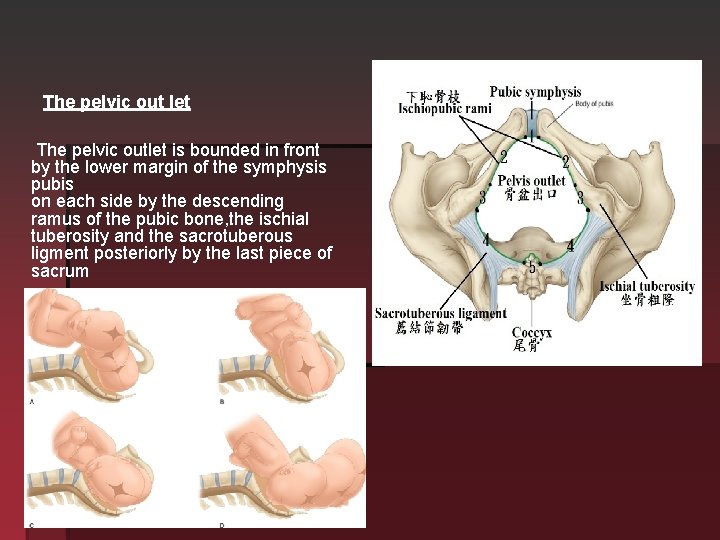 The pelvic out let The pelvic outlet is bounded in front by the lower