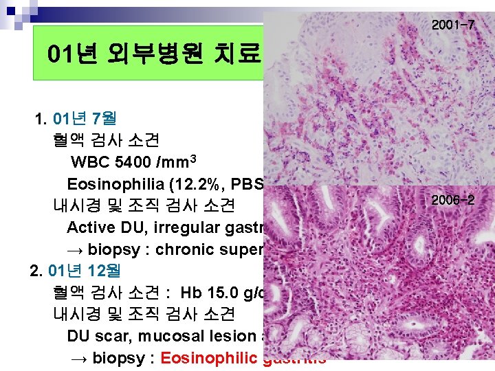 2001 -7 01년 외부병원 치료 기록 1. 01년 7월 혈액 검사 소견 WBC 5400 2001 -7 01년 외부병원 치료 기록 1. 01년 7월 혈액 검사 소견 WBC 5400