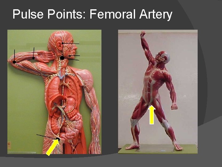 Pulse Points: Femoral Artery 