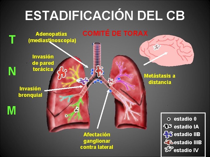 ESTADIFICACIÓN DEL CB T N Adenopatías (mediastinoscopia) COMITÉ DE TORAX Invasión de pared torácica