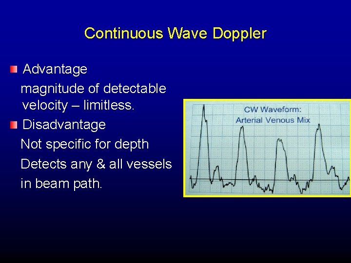 Continuous Wave Doppler Advantage magnitude of detectable velocity – limitless. Disadvantage Not specific for