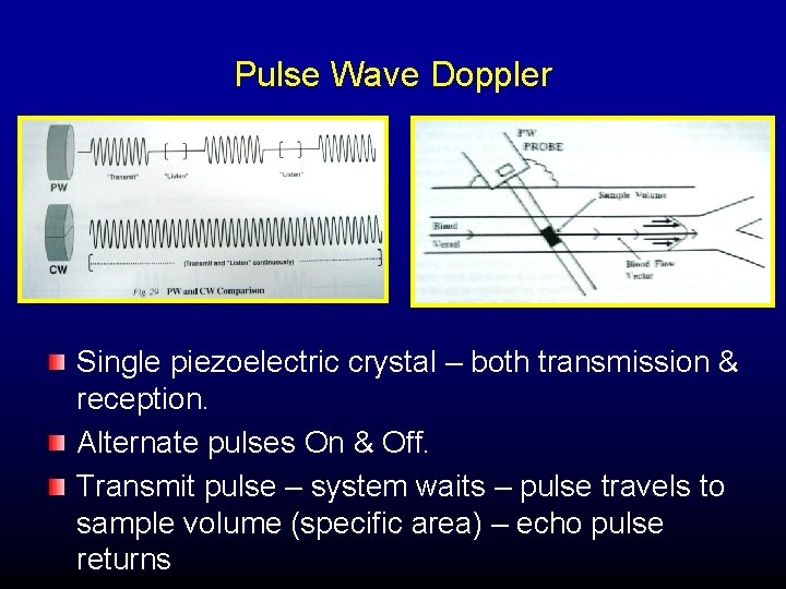 Pulse Wave Doppler Single piezoelectric crystal – both transmission & reception. Alternate pulses On