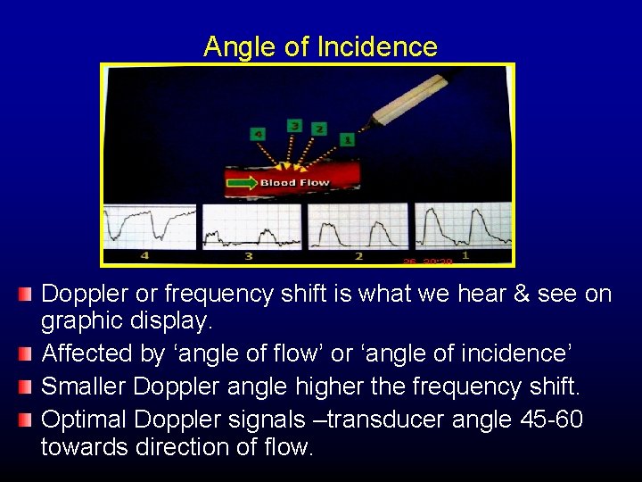 Angle of Incidence Doppler or frequency shift is what we hear & see on