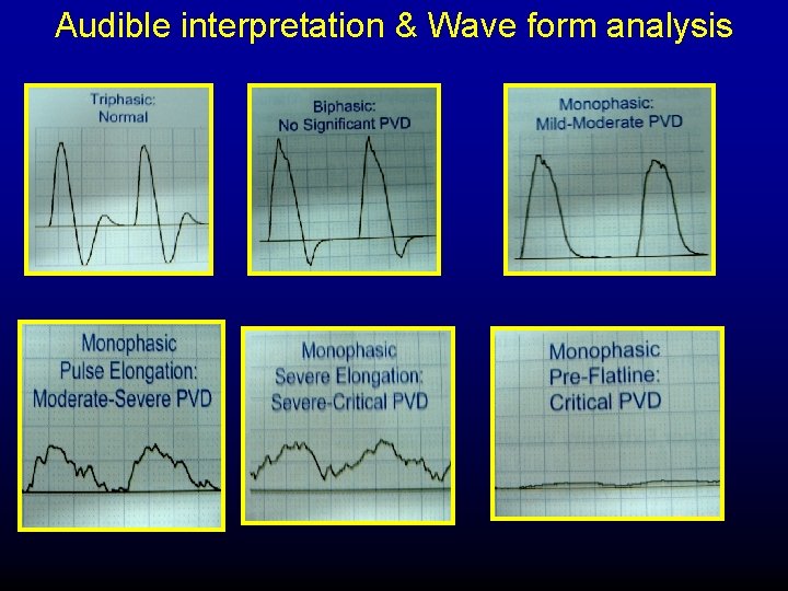 Audible interpretation & Wave form analysis 