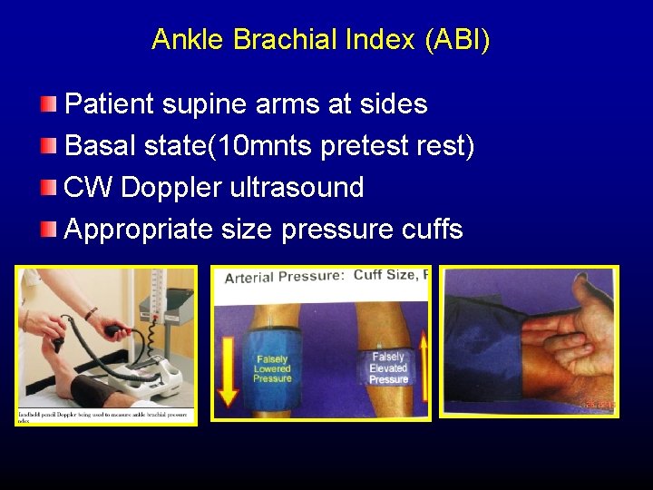 Ankle Brachial Index (ABI) Patient supine arms at sides Basal state(10 mnts pretest rest)