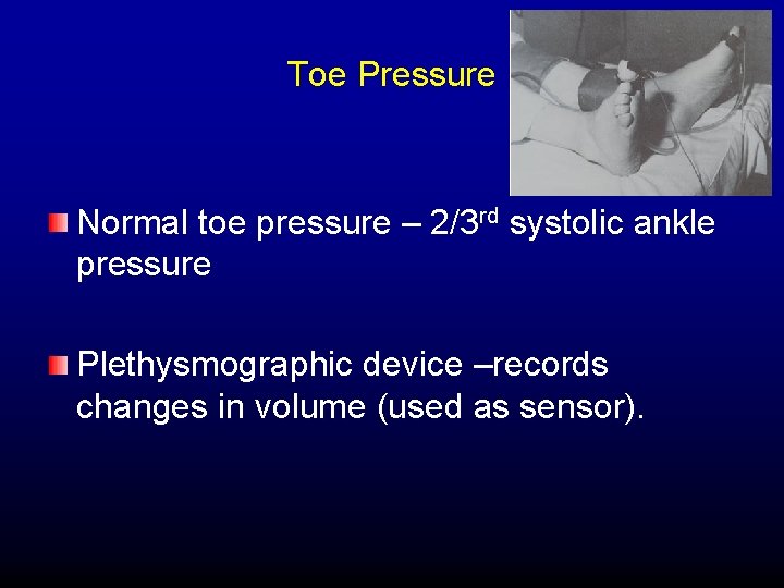 Toe Pressure Normal toe pressure – 2/3 rd systolic ankle pressure Plethysmographic device –records