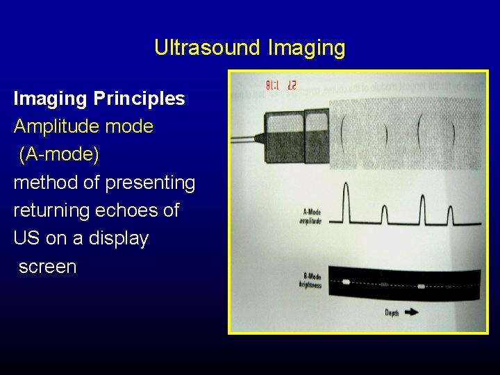 Ultrasound Imaging Principles Amplitude mode (A-mode) method of presenting returning echoes of US on
