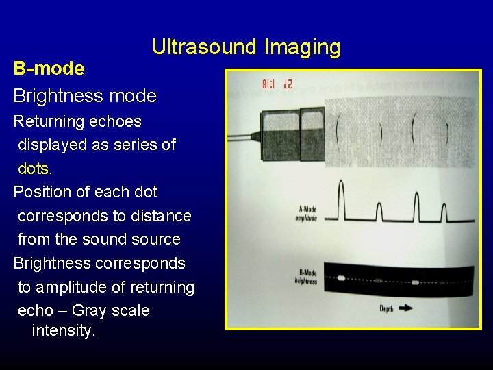 Ultrasound Imaging B-mode Brightness mode Returning echoes displayed as series of dots. Position of