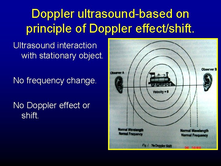 Doppler ultrasound-based on principle of Doppler effect/shift. Ultrasound interaction with stationary object. No frequency