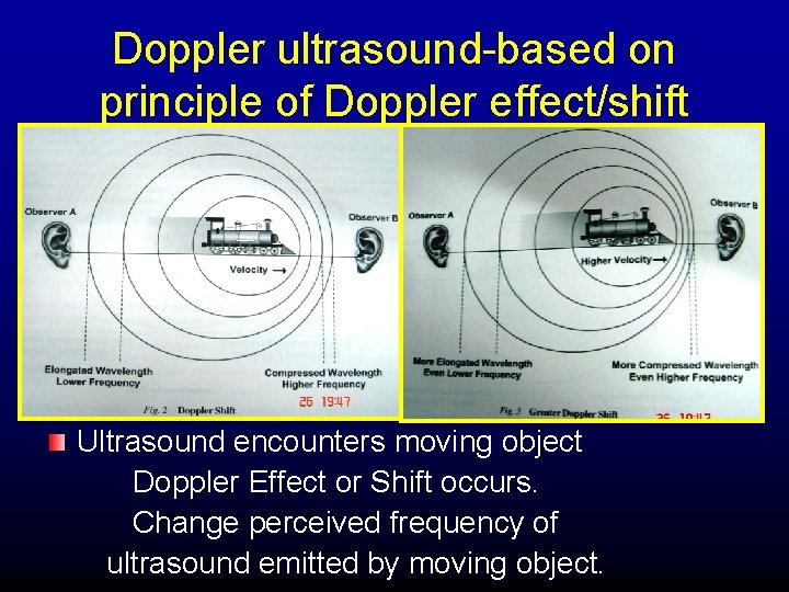 Doppler ultrasound-based on principle of Doppler effect/shift Ultrasound encounters moving object Doppler Effect or