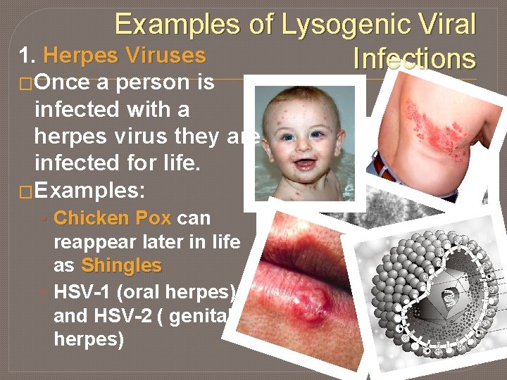 Examples of Lysogenic Viral 1. Herpes Viruses Infections �Once a person is infected with