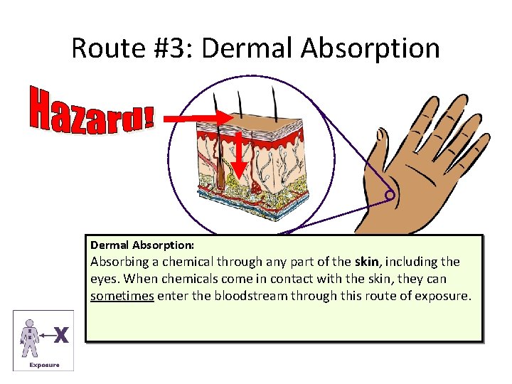 Route #3: Dermal Absorption: Absorbing a chemical through any part of the skin, including