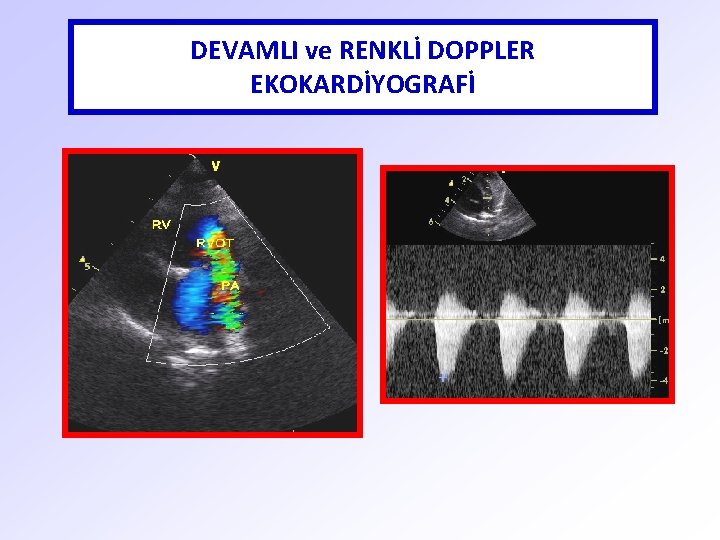 DEVAMLI ve RENKLİ DOPPLER EKOKARDİYOGRAFİ 