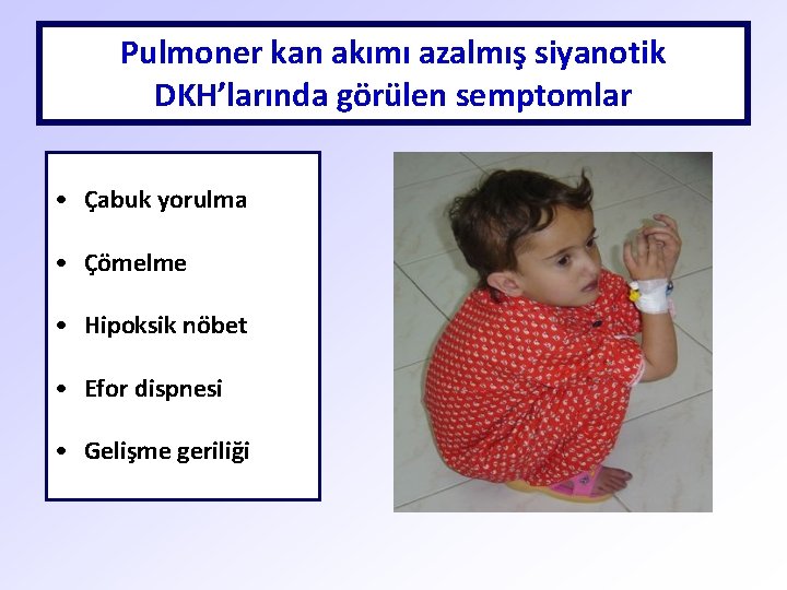 Pulmoner kan akımı azalmış siyanotik DKH’larında görülen semptomlar • Çabuk yorulma • Çömelme •