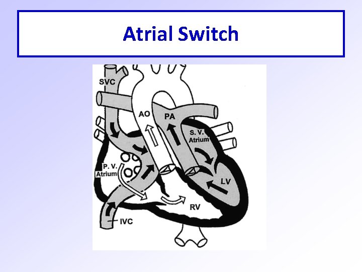 Atrial Switch 