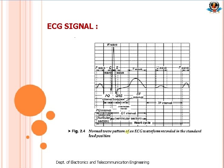 ECG SIGNAL : Dept. of Electronics and Telecommunication Engineering ECG SIGNAL : Dept. of Electronics and Telecommunication Engineering