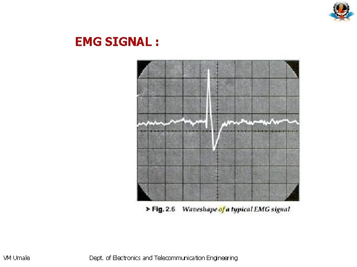 EMG SIGNAL : VM Umale Dept. of Electronics and Telecommunication Engineering EMG SIGNAL : VM Umale Dept. of Electronics and Telecommunication Engineering