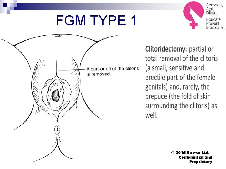 FGM TYPE 1 © 2015 Bawso Ltd. Confidential and Proprietary 