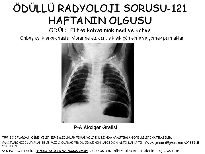 ÖDÜLLÜ RADYOLOJİ SORUSU-121 HAFTANIN OLGUSU ÖDÜL: Filtre kahve makinesi ve kahve Onbeş aylık erkek