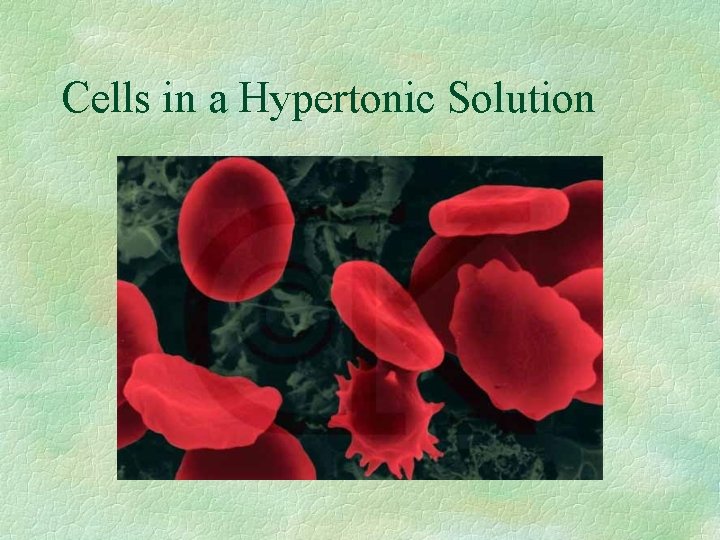 Cells in a Hypertonic Solution 