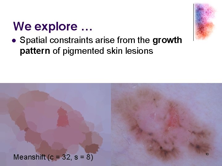 We explore … l Spatial constraints arise from the growth pattern of pigmented skin