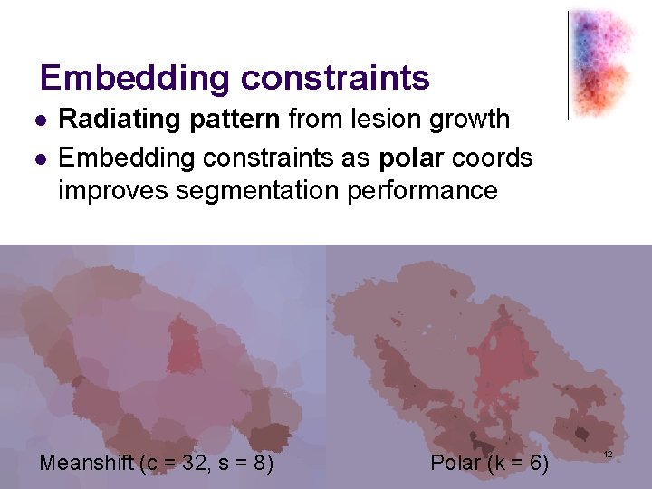 Embedding constraints l l Radiating pattern from lesion growth Embedding constraints as polar coords