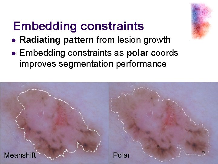Embedding constraints l l Radiating pattern from lesion growth Embedding constraints as polar coords