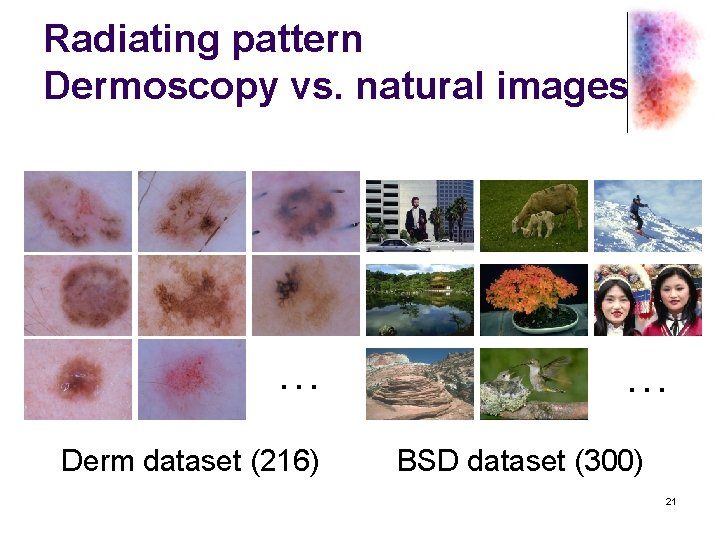 Radiating pattern Dermoscopy vs. natural images … Derm dataset (216) … BSD dataset (300)