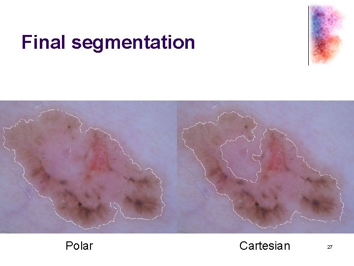 Final segmentation Polar Cartesian 27 