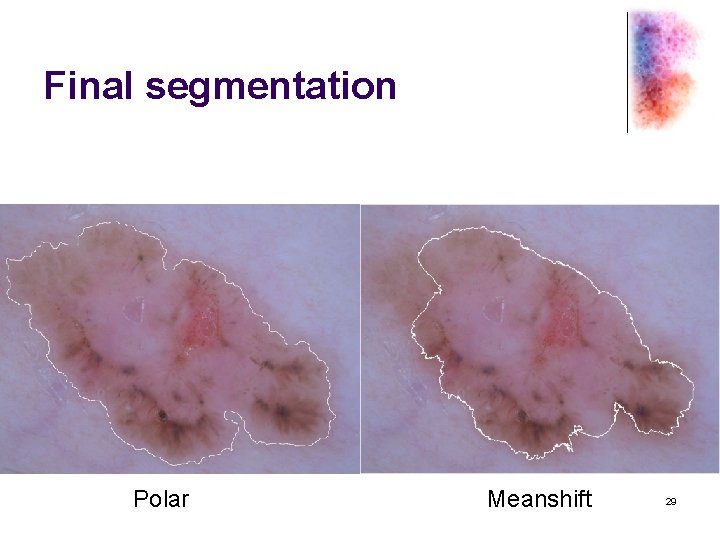 Final segmentation Polar Meanshift 29 