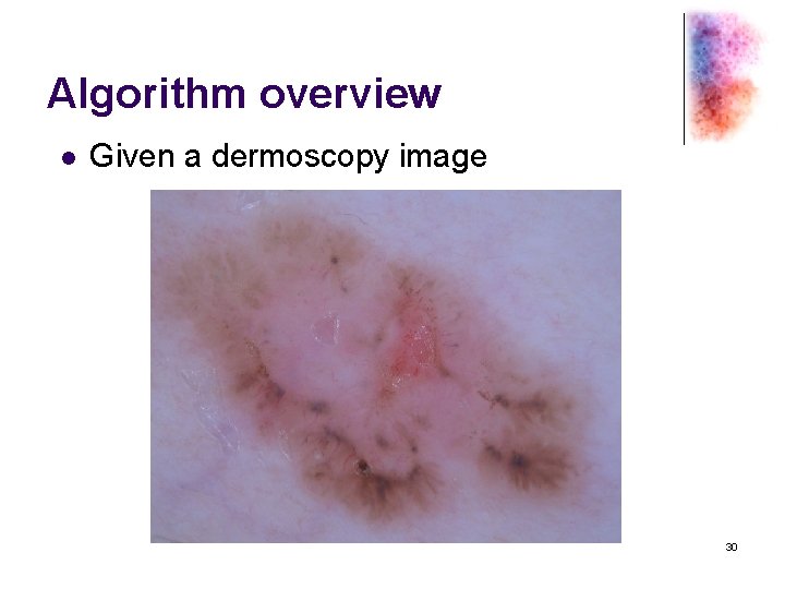 Algorithm overview l Given a dermoscopy image 30 