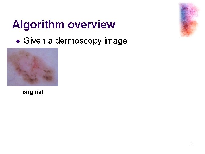Algorithm overview l Given a dermoscopy image original 31 