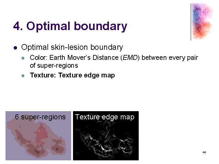 4. Optimal boundary l Optimal skin-lesion boundary l l Color: Earth Mover’s Distance (EMD)