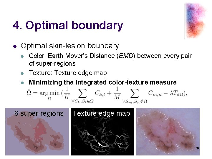 4. Optimal boundary l Optimal skin-lesion boundary l l l Color: Earth Mover’s Distance
